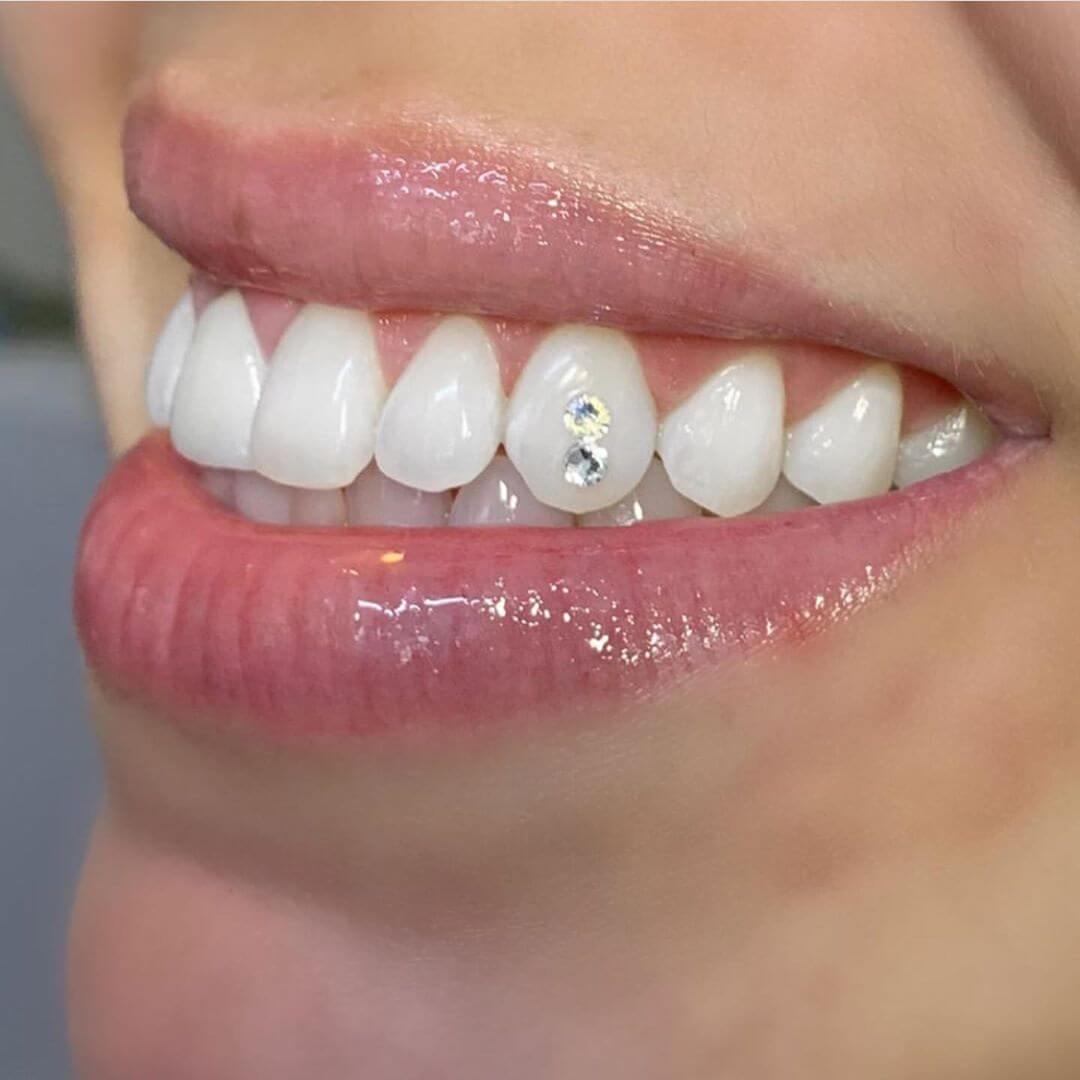 Tooth Diamond-Dental Clinic