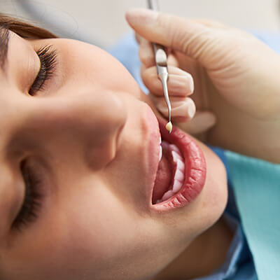 Inlay-Onlay-Dental Clinic