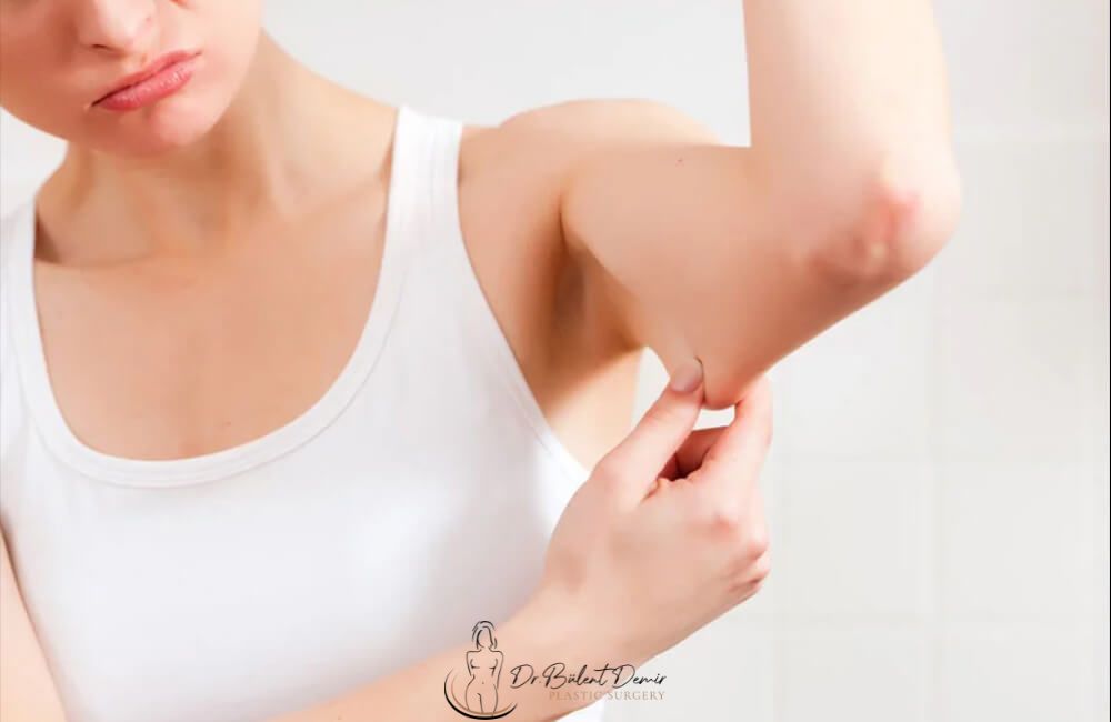 Arm Lift in turkey Antalya