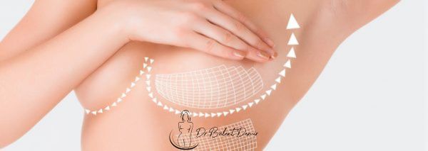 breast lift in turkey Antalya