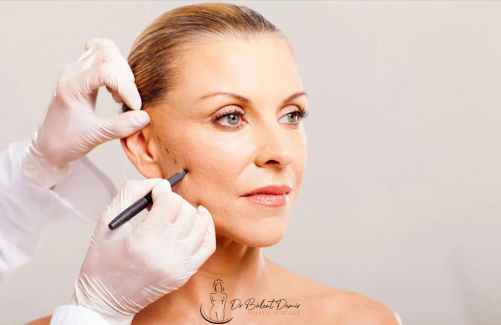 Cheek fat reduction in turkey Antalya