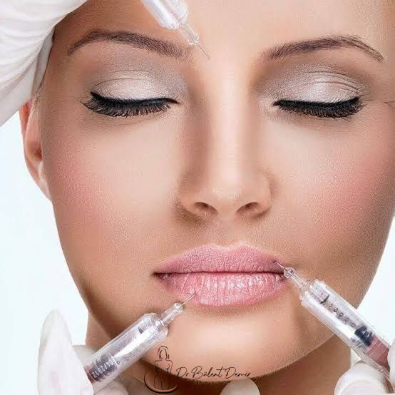 Dermal Fillers in Turkey Antalya