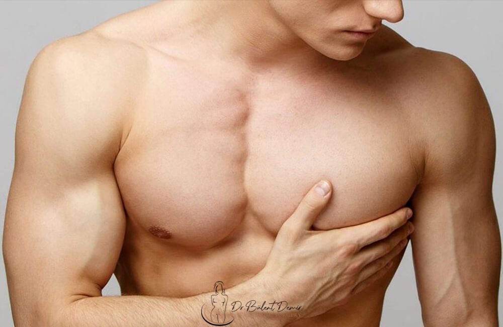 Male Breast Reduction in turkey Antalya