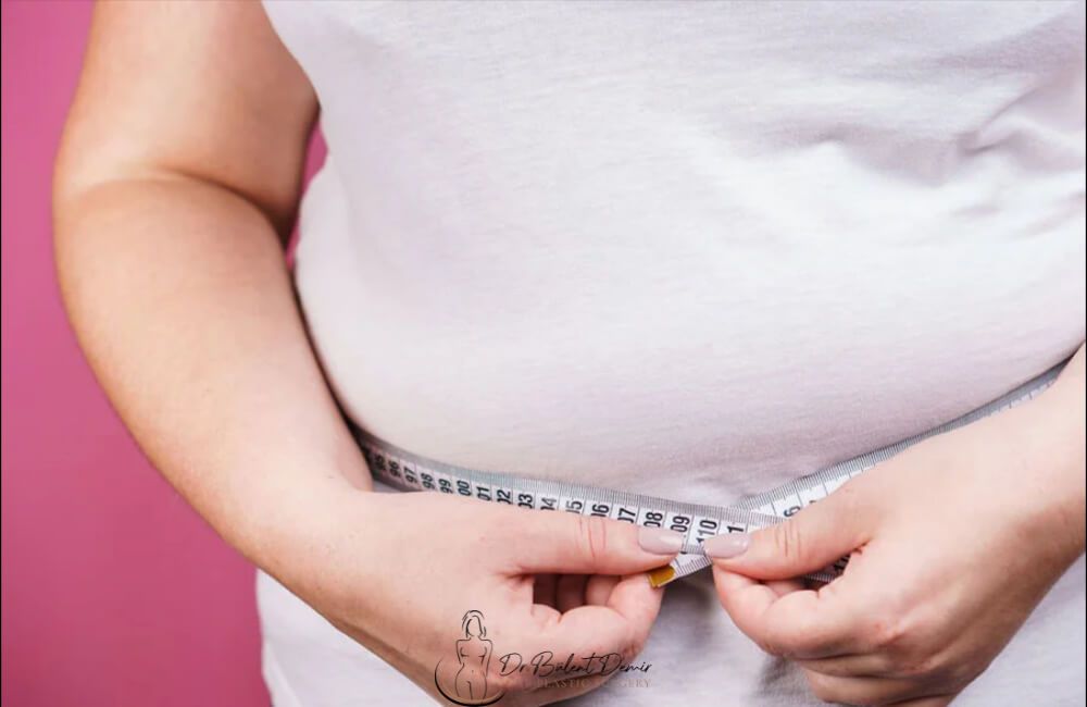 Obesity Surgery in turkey Antalya