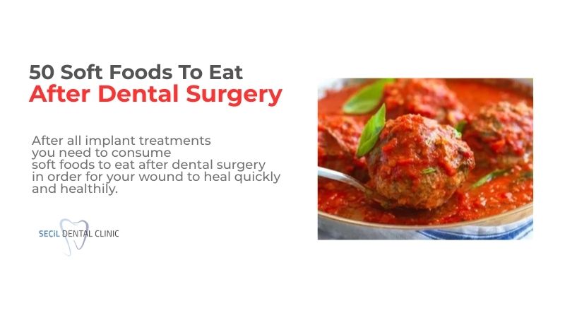 50 Soft foods to eat after dental surgery
