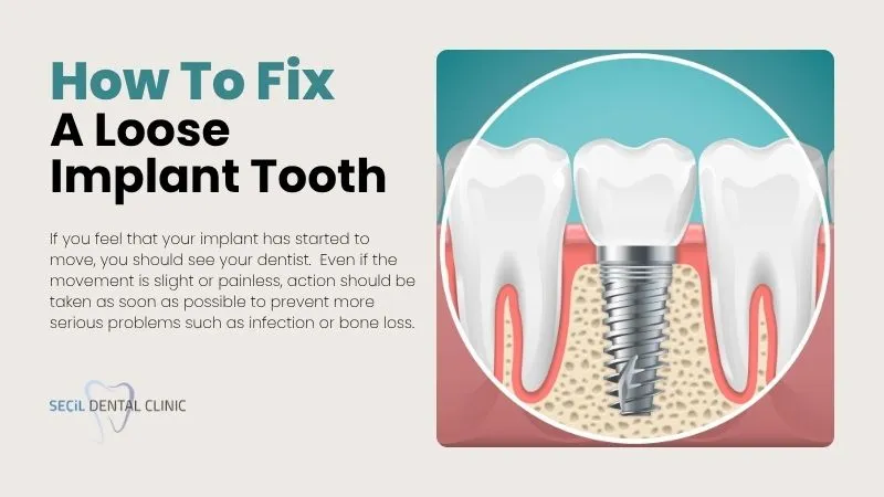 A Loose Implant Tooth