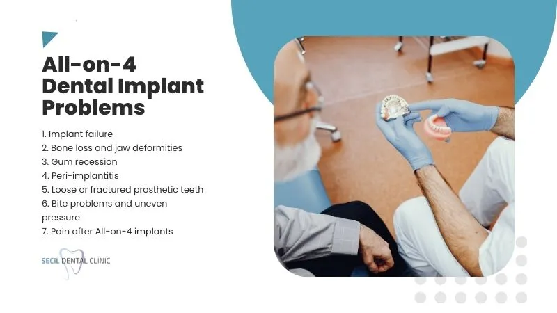 All on 4 dental implants problems