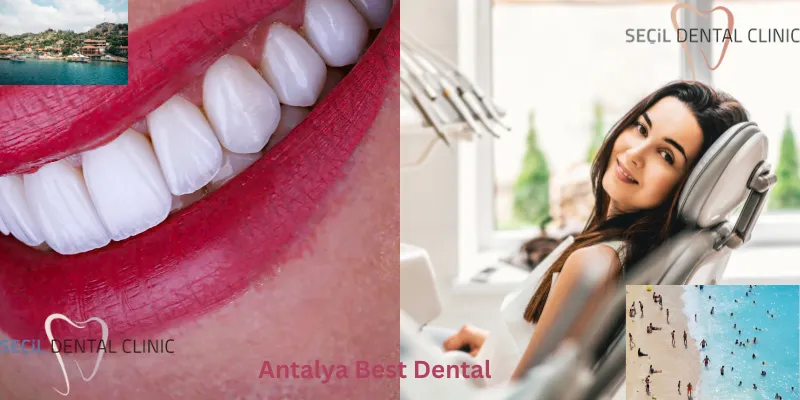 Antalya Best Dental