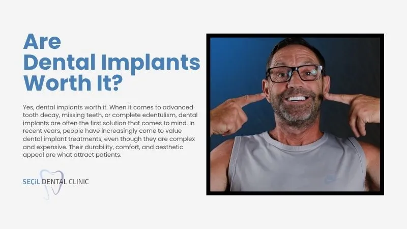  Are dental implants worth it? Antalya