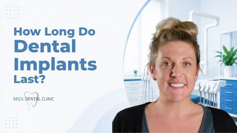 How Long Do Dental Implants Last