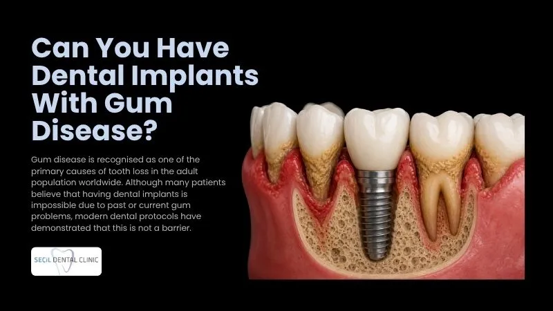 Dental implants with gum disease Antalya