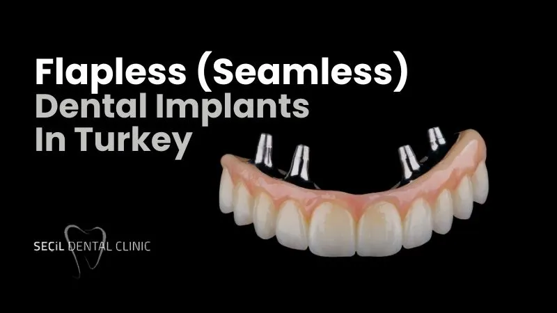 Flapless Dental Implants in Turkey