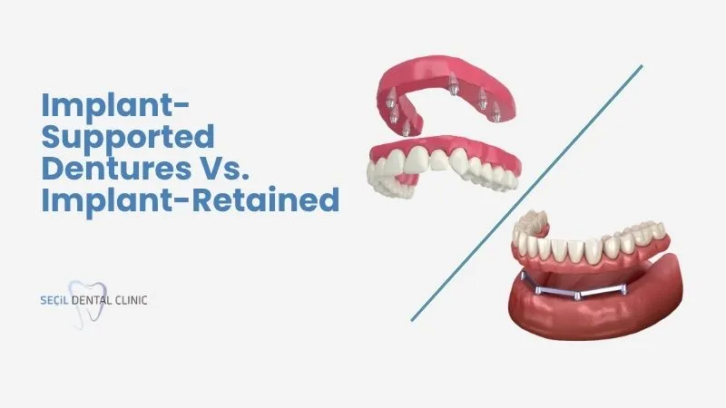 Implant supported dentures vs Implant retained Antalya