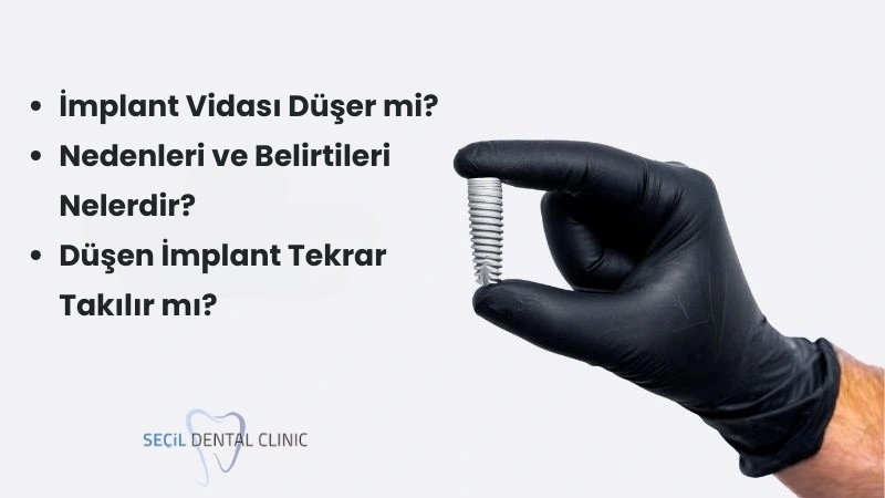 İmplant Vidası Düşer mi?