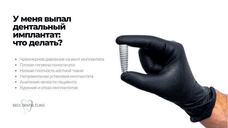 У меня выпал дентальный имплантат: что делать?
