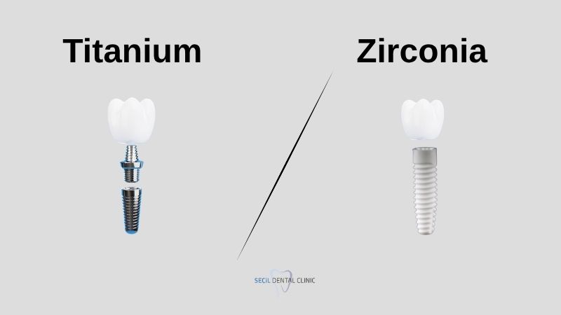 Zirconia or Titanium Implants?