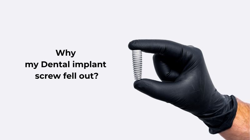 Dental Implants Antalya