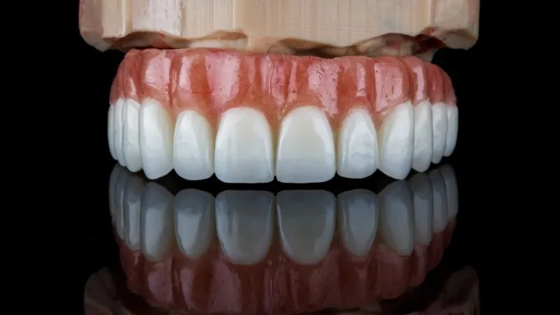 Dental Implants Antalya