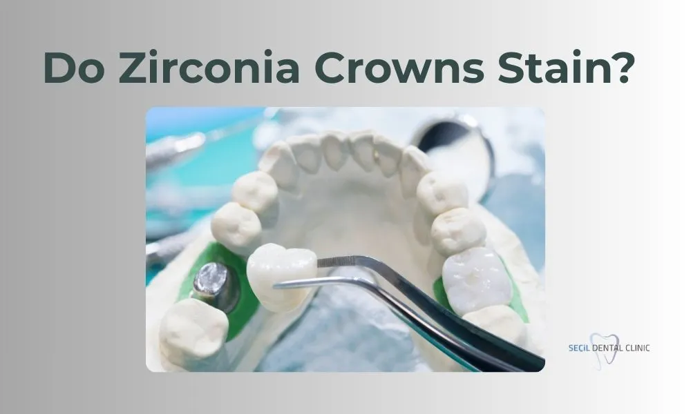 Do zirconia crowns stain
