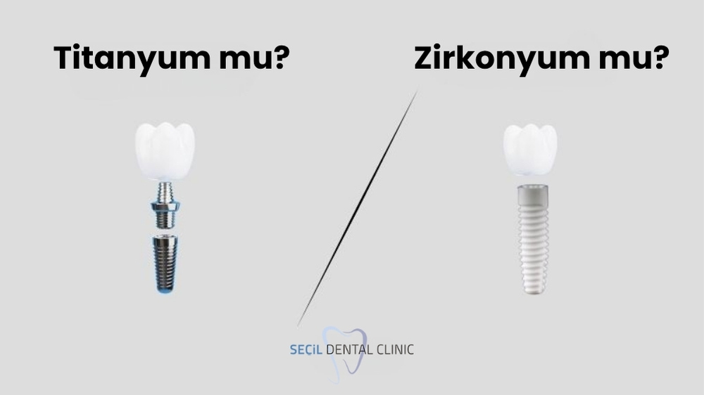 Zirkonyum mu? Titanyum mu? Hangi İmplant Daha İyi?