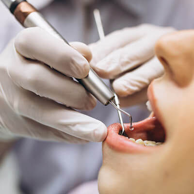 Adhesive-Bonding Applications-Dental Clinic