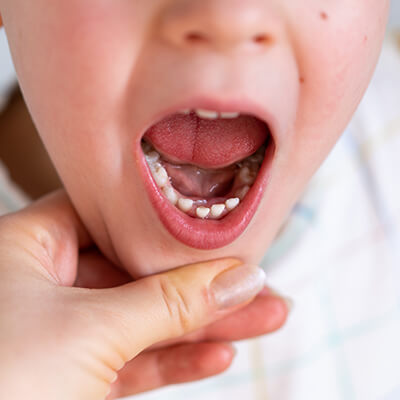 Pediatric Dentistry-Dental Clinic