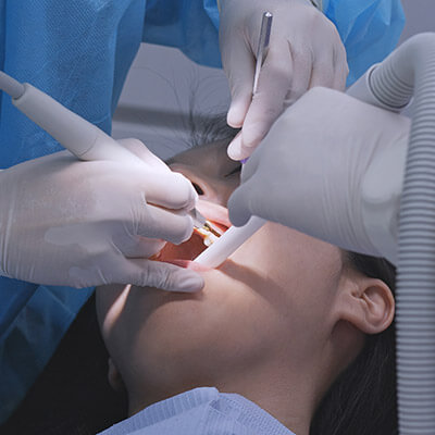Dental Tartar Cleaning-dental-clinic
