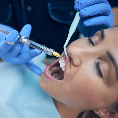 Epulis Treatment-Dental Clinic