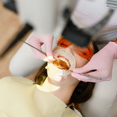 Frenectomy-Dental Clinic