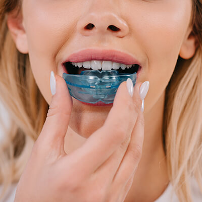Orthodontic (Braces) Treatments-Dental Clinic