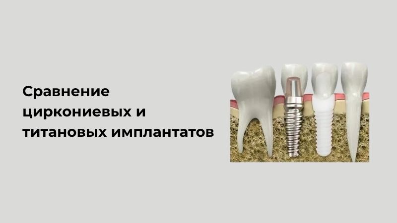 Циркониевые и титановые имплантаты